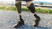 3d printed prosthetic sockets