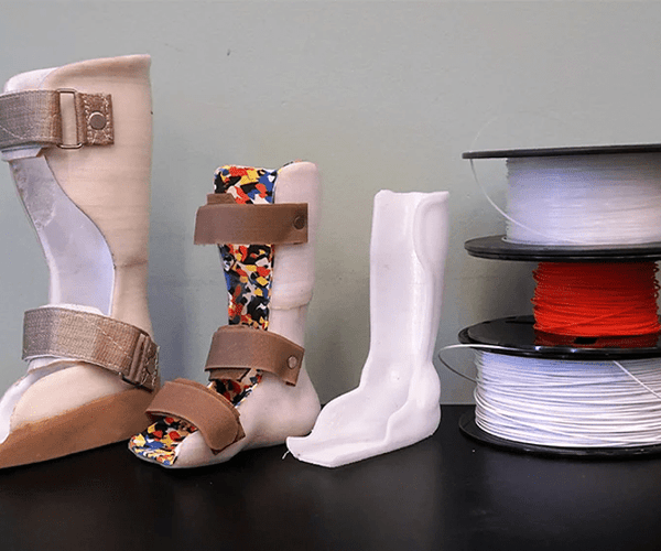Why FDM 3D Printing Shouldn’t Be Used for AFOs – Qaadir - Ability for All