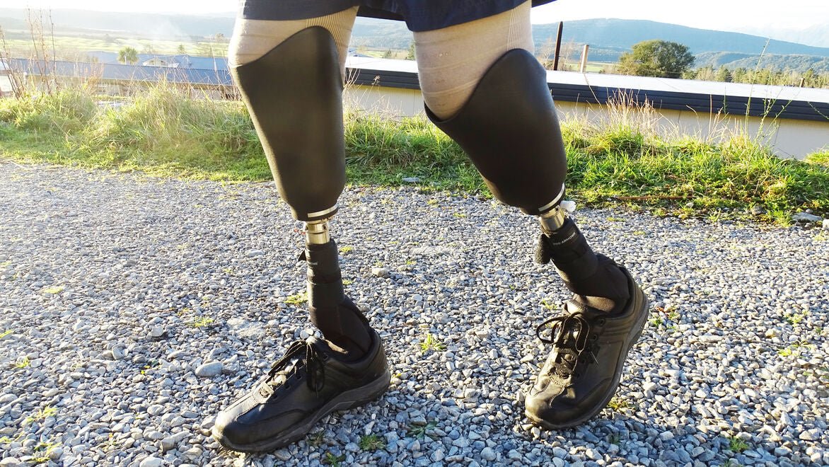 3d printed prosthetic sockets