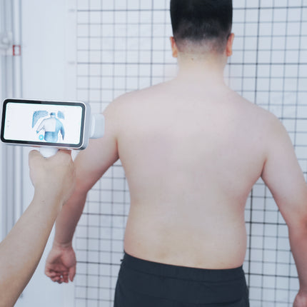 Shining 3D Einscan Medixa Orthotics & Prosthetics 3D Handheld Scanner