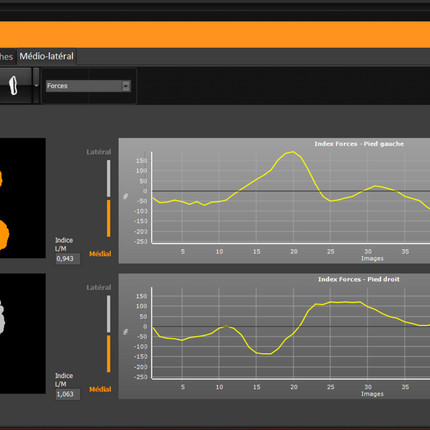 Qaadir Insight Wireless Pressure Plate System