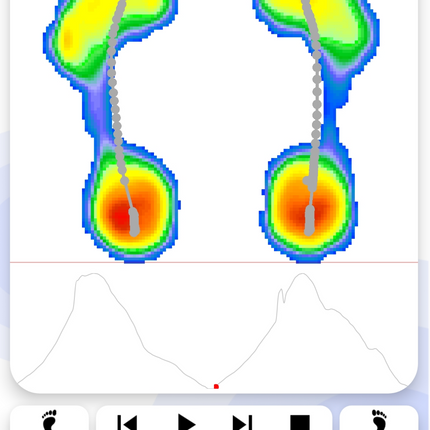 Qaadir Insight Mini – Bluetooth Foot Pressure Plate for Diabetic Foot Screening and Gait Assessment