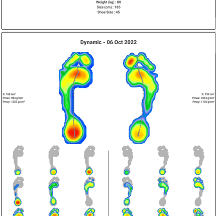 Qaadir Insight Mini – Bluetooth Foot Pressure Plate for Diabetic Foot Screening and Gait Assessment