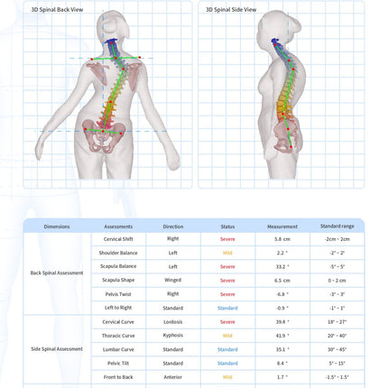 Qaadir 3D Scoliosis & Body Scanning System - Qaadir