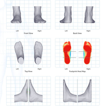 Qaadir iQube View 3D Foot Scanning System - Qaadir - Ability for All