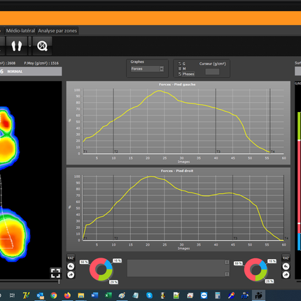 Qaadir Insight Wireless Pressure Plate System