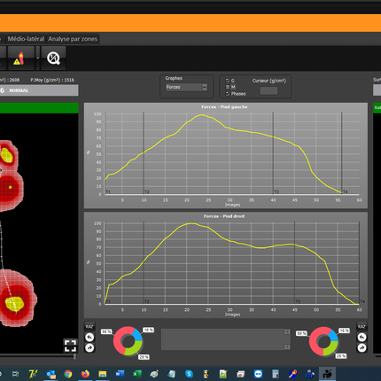 Qaadir Insight Wireless Pressure Plate System